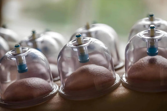 Complete Guide to Cupping Therapy: Ancient Chinese Wisdom Meets Modern Science for Pain Relief and Circulation - STAR8S