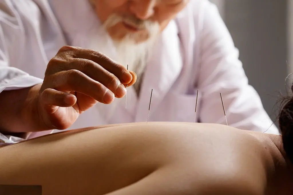 Is Acupuncture Right for You? A Beginner’s Guide to Understanding This Ancient Therapy  - STAR8S
